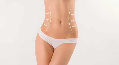 Best Liposuction Treatment Thane