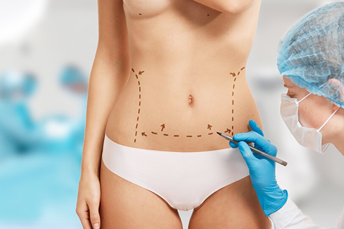 Affordable Liposuction Treatment Thane