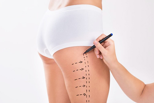 Best Liposuction Specialist Thane