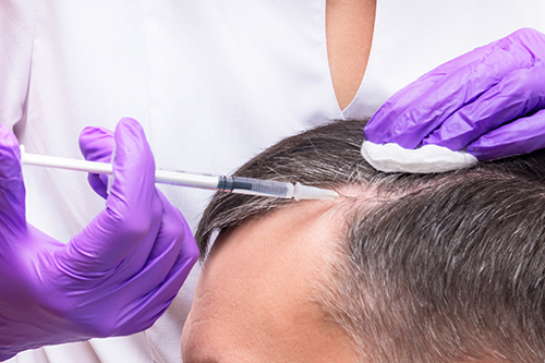 Hair Transplant Treatment in Thane